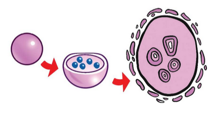lysosome